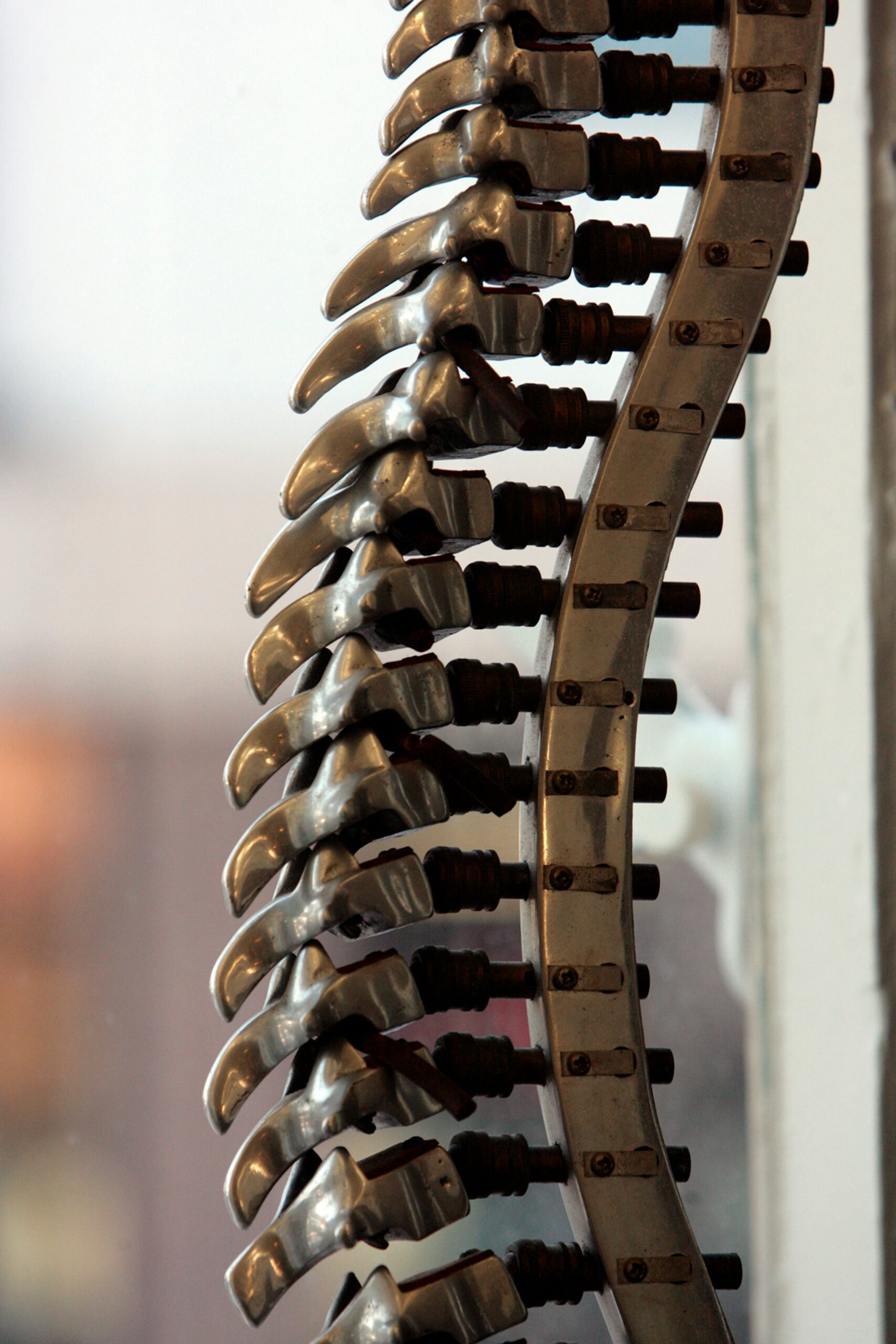 Spinal Innovation